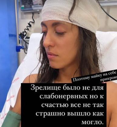 Актриса Анастасия Меськова получила травму головы во время отдыха